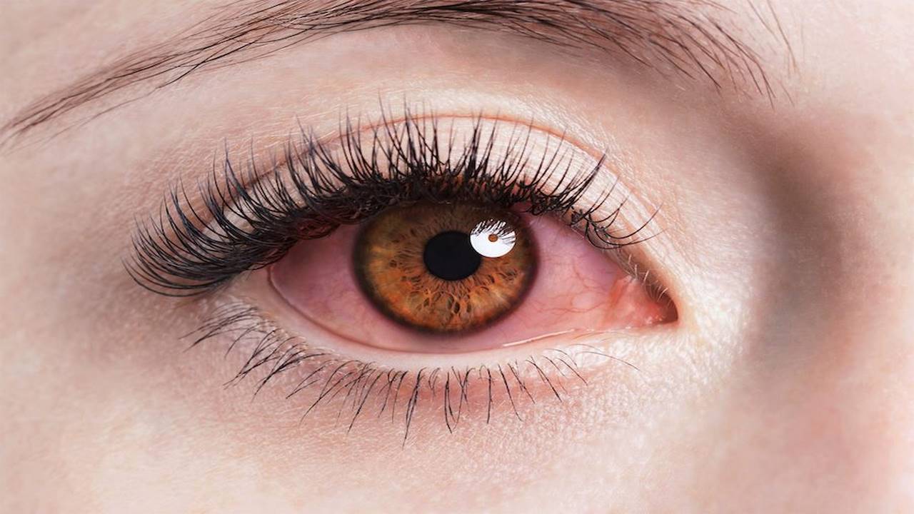 Cách điều trị đau mắt hữu hiệu nhất