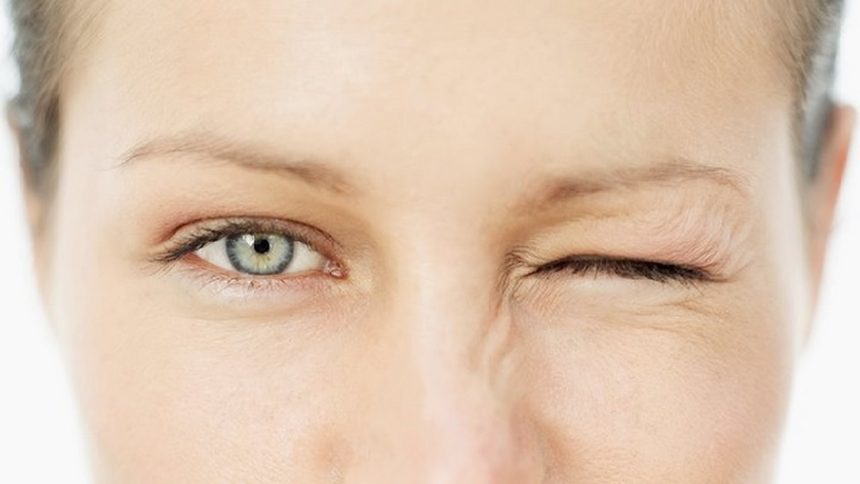 Nháy mắt liên tục là hiện tượng gì ? Liệu mắt nháy liên tục có nguy hiểm ?